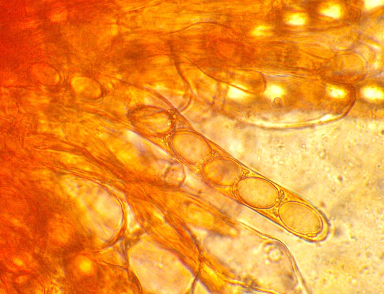 Morchella esculenta, ascospores en développement